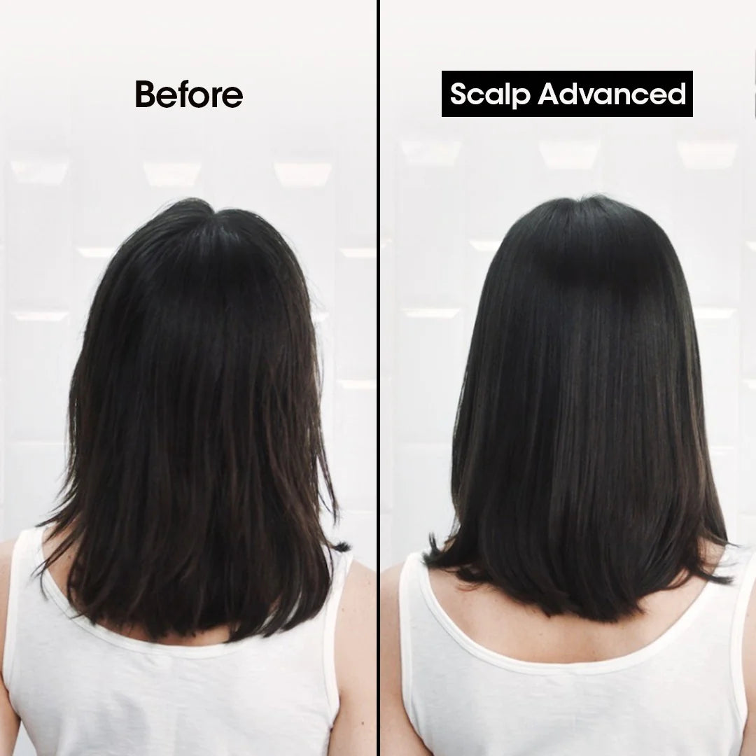 Loreal Professionnel Scalp Advanced Anti-Dandruff Shampoo - 300 ML