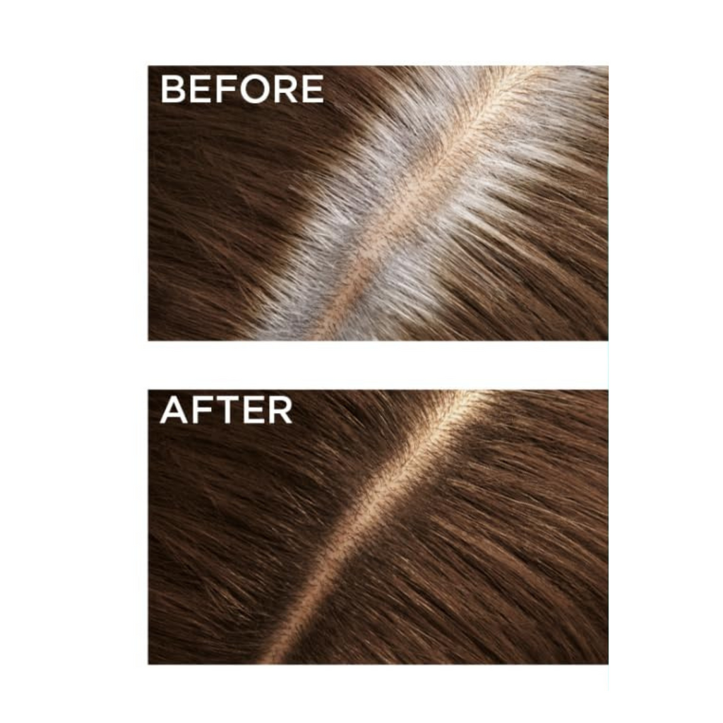 Loreal Magic Retouch Concealer Spray Medium Brown 75 Ml