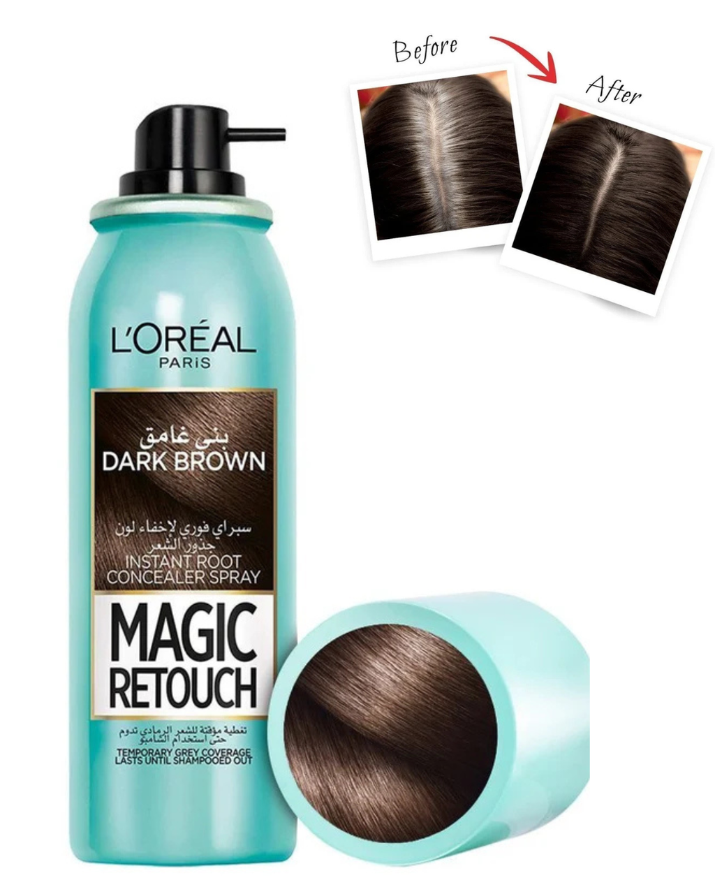 Loreal Magic Retouch Hair Root Concealer Spray Dark Brown - 75 Ml